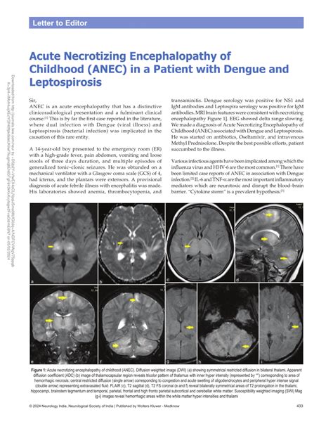 Pdf Acute Necrotizing Encephalopathy Of Childhood Anec In A Patient