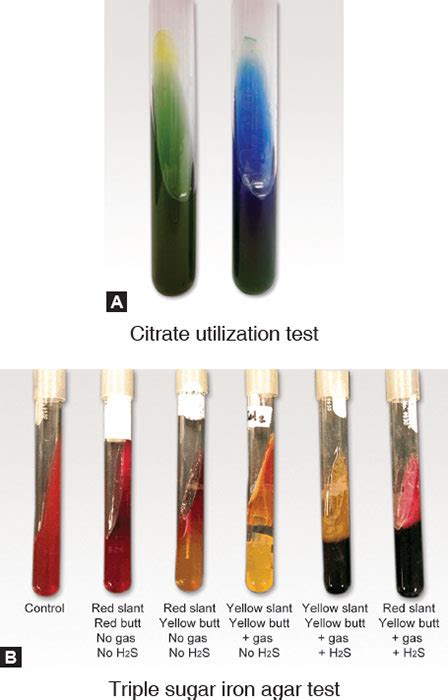 Triple Sugar Iron Tsi Agar Principle Results And Off