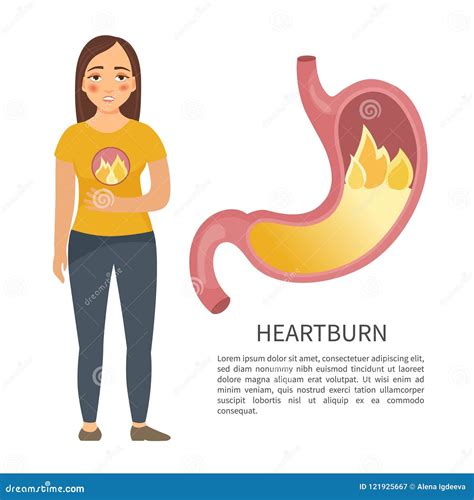 Infographics De La Gastritis Ilustración del Vector Ilustración de