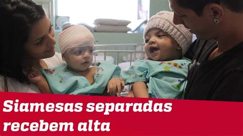 Gêmeas Siamesas Separadas Por Cirurgia No Df Recebem Alta De Hospital Após 36 Dias Youtube