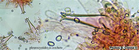 Microscopie Cystides De Pluteus Pouzarianus N Macau B Clesse