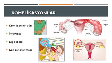 Pelvik Inflamatuar Hastal K Prof Dr Ba Ak Baksu