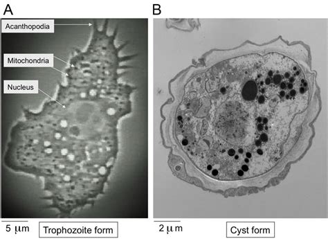 Acanthamoeba Figure