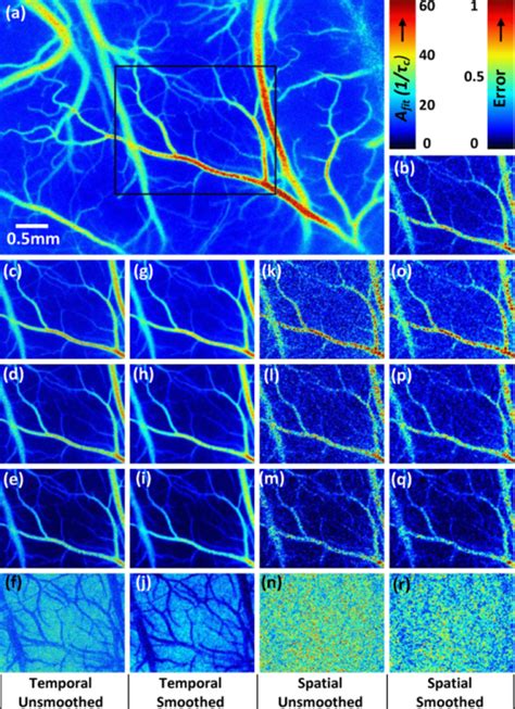 Multiexposure laser speckle contrast imaging of the angiogenic ... 