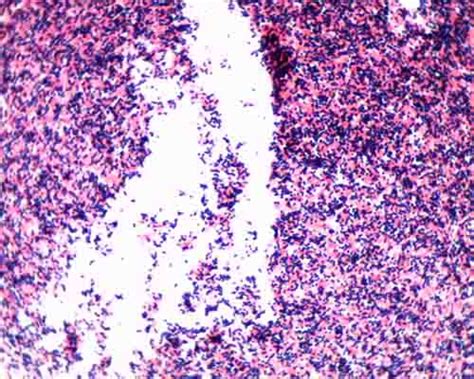 √100以上 e coli morphology gram stain 283207-E.coli gram stain morphology ...