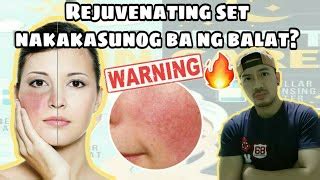 gamot sa nasunog na mukha dahil sa toner
