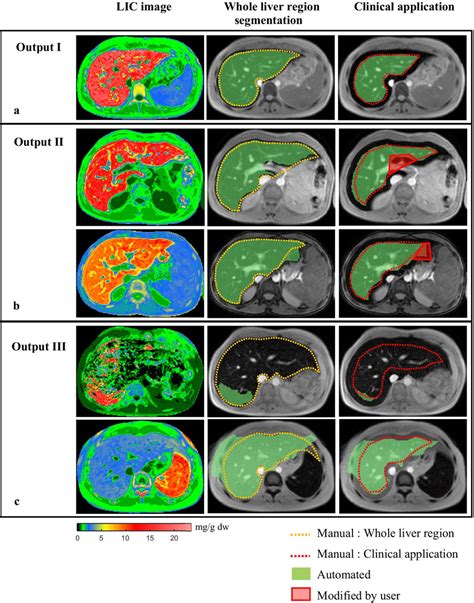 The Example Of Segmentation Results In Each Category From Five Download Scientific Diagram