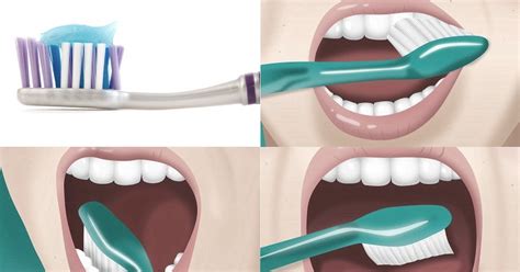 Esencialdent Odontología Movil Pasos Para Cepillarse Los Dientes