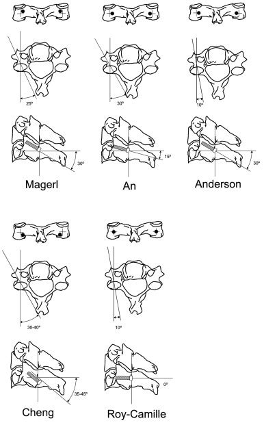 Lateral Mass Screws Musculoskeletal Key