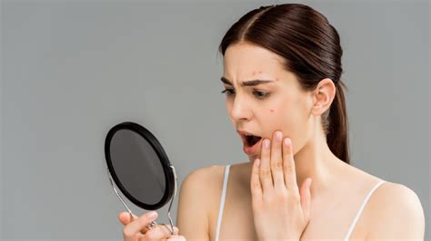 Can You Get Acne After Sex Find Your Answer Here Healthshots