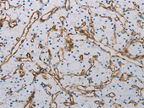 Pecam Anti Pecam Rabbit Polyclonal Antibody