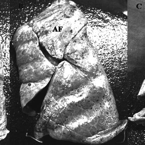 The Left Lung Specimens Having The Different Variant Patterns A