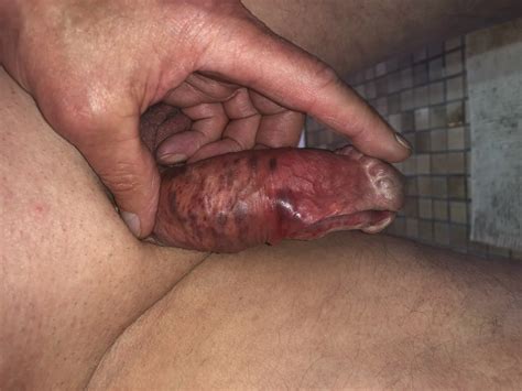 Losers Cock And Torture Nude Pics Xhamster