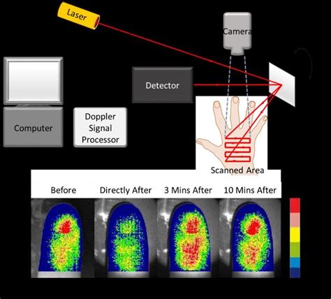 Laser Doppler Perfusion Imaging Ldpi A A Schematic Diagram