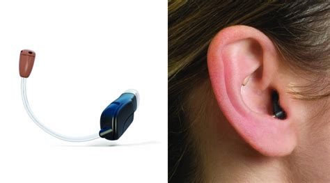 Beltone Prime™ And Prime Plus™ Beltone California Hearing Aids