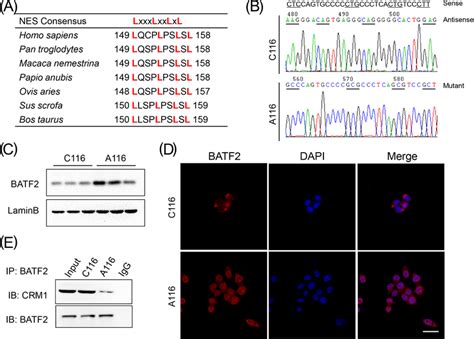 Chromosome Region Maintenance 1 Crm1 Negatively Correlates With