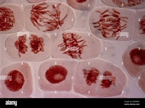 Mitosis Light Micrograph Stock Photo Alamy