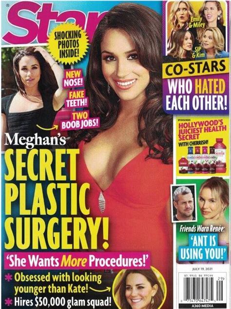 Meghan Markle Plastic Surgery Reveal On ABC Nightline Featuring Dr