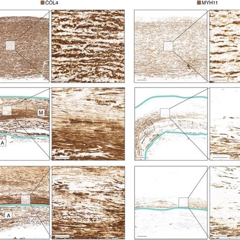 COL4 and MYH11 immunohistochemical staining of non-lesioned ascending ... 