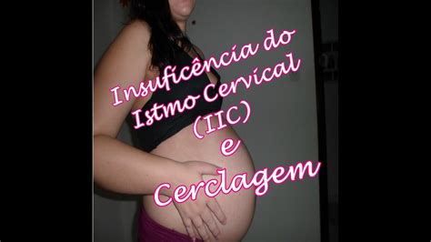 Insufici Ncia Istmo Cervical Iic E Cerclagem Gravidez De Risco Youtube