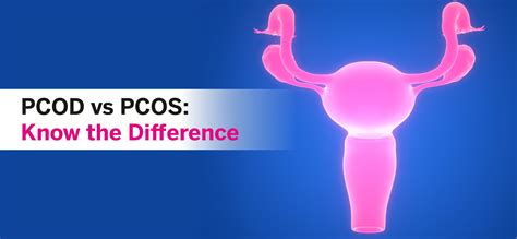 Pcod Vs Pcos Know The Difference Aakash Healthcare