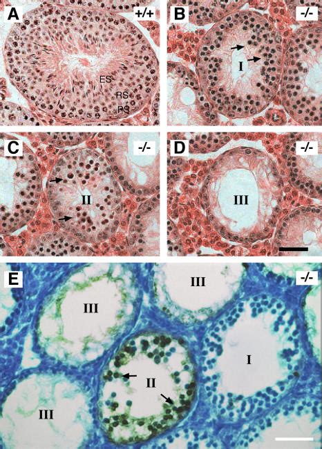 Meiotic Arrest And Apoptosis Of Spermatocytes In Sycp Mice Testes