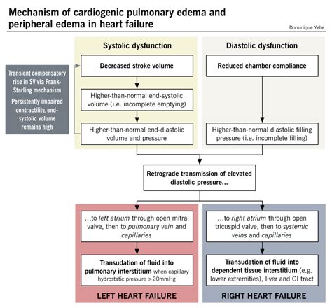 Mechanism of cardiogenic pulmonary edema and peripheral edema in heart ...