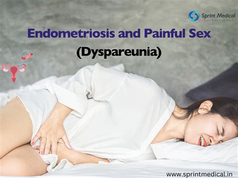 Endometriosis And Painful Sex Dyspareunia Sprint Medical