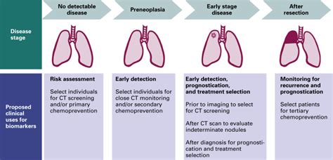 Lung Cancer Diagnosis