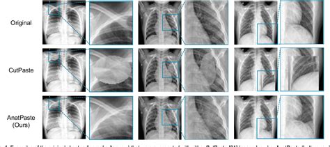 Figure From Anatomy Aware Self Supervised Learning For Anomaly