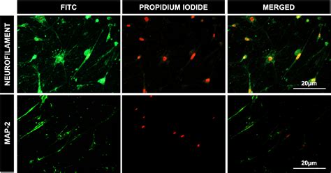 Video: Author Spotlight: Advancing Tissue Regeneration and Disease ... 