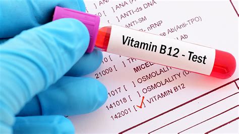 Vitamin B12 Deficiency Symptoms And Testing