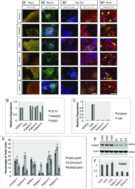 Characterization Of Pank Ipscs And Differentiated Neuronal Cultures