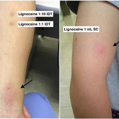 Diffuse Erythematous Pruritic Non Urticarial Rash Located At And Download Scientific Diagram