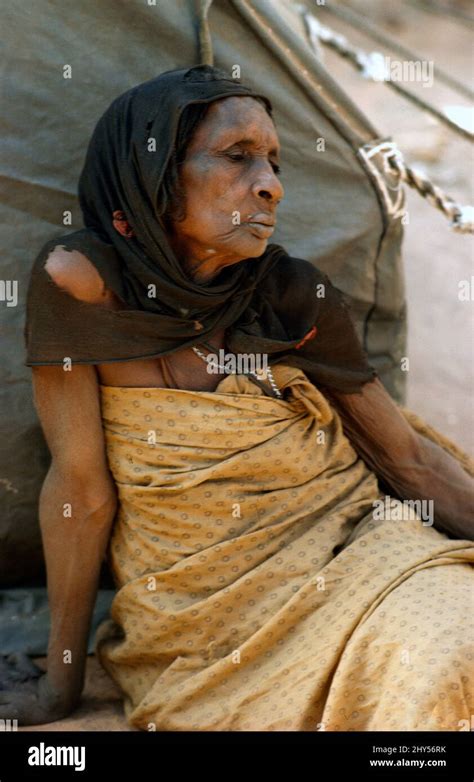 El Geneina Sudan Woman Suffering from Leprosy Stock Photo - Alamy