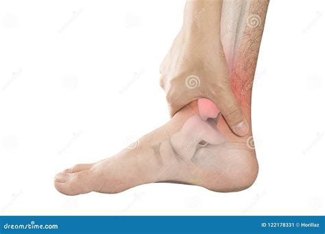 Foot bones pain stock image. Image of osteoporosis, office - 122178331