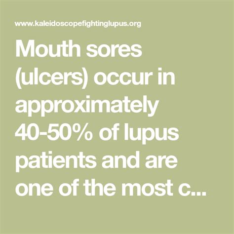 Mouth sores (ulcers) occur in approximately 40-50% of lupus patients and are one of the most ...