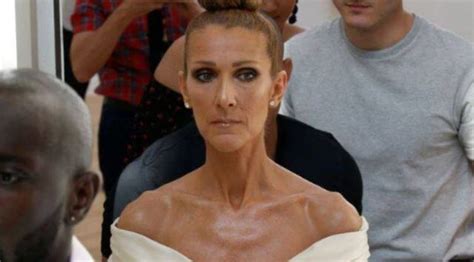 Celine Dion Cancels Rest Of World Tour Due To Medical Condition Music News The Indian Express