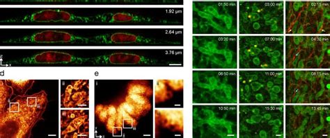 Dual Color 2d And 3d Sted Imaging In Fixed Whole Cells And Live Cell Download Scientific