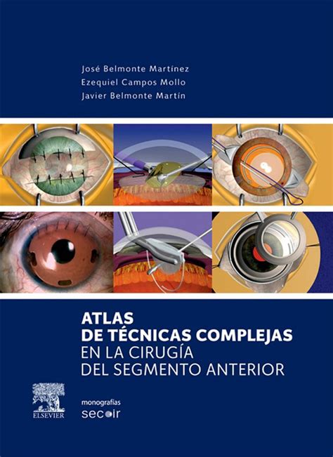 Atlas de técnicas complejas en la cirugía del segmento anterior 電子書籍 作