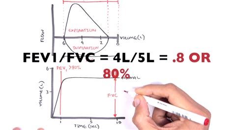 Understanding Spirometry - Normal, Obstructive vs Restrictive - Medical Discover