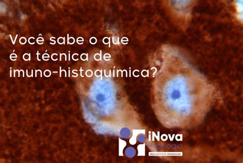 Voc Sabe O Que A T Cnica De Imuno Histoqu Mica Inova Patologia