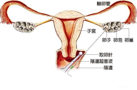 請給你的子宮系好安全帶！出現這5種情況，說明子宮不好了 每日頭條