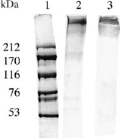 Analysis Of Purified Pregnancy Associated Plasma Protein A Papp A On