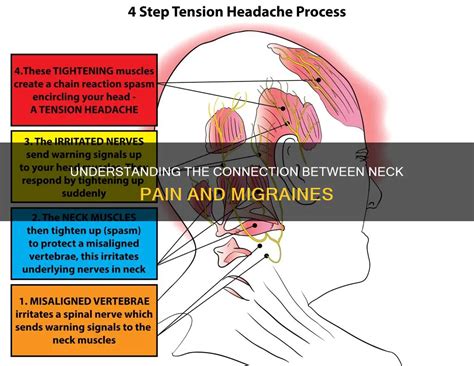 Understanding The Connection Between Neck Pain And Migraines MedShun