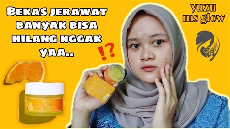 Review Ms Glow Revitalizing Juice Moisturizer Yuzu Moisturizer Ms