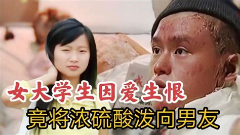 男友提出分手，女大学生因爱生恨竟乔装打扮将浓硫酸泼向男友！二 影视综视频 搜狐视频