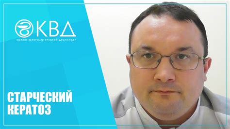 6 лучших методов лечения старческой кератомы (возрастной)