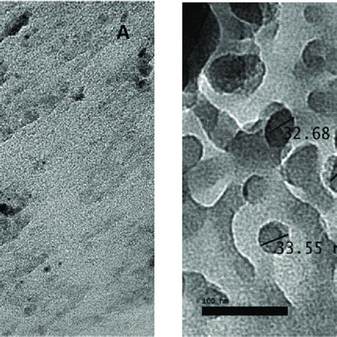 Tem Images And Size Distribution Of Chitosan Nanoparticles Download Scientific Diagram