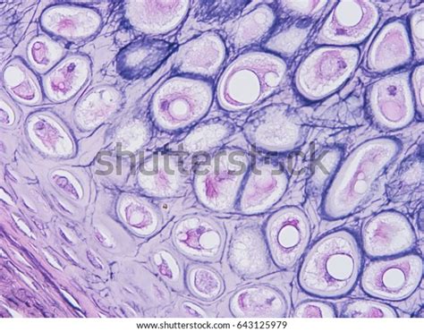 563 Elastic Cartilage Images, Stock Photos & Vectors | Shutterstock